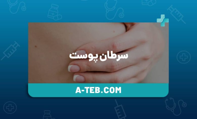 زنگ خطرهای «سرطان پوست» کدامند؟