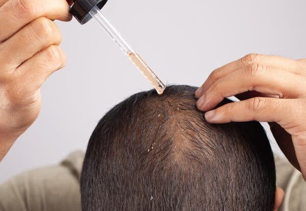 چطور ریزش مو را کنترل کنیم؟