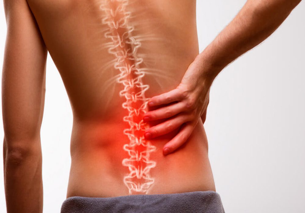 تفاوت دیسک کمر با عصب سیاتیک را بشناسید