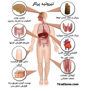 اختلال تیروئید چه بلایی سر بدنمان می آورد؟ +تصویر