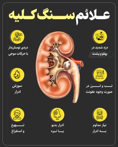 سنگ کلیه با چه روش‌هایی دفع می‌شود؟