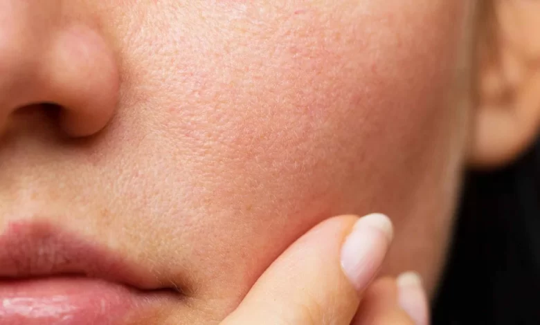 ساخت مجدد پوست انسان به کمک سلول های بنیادی