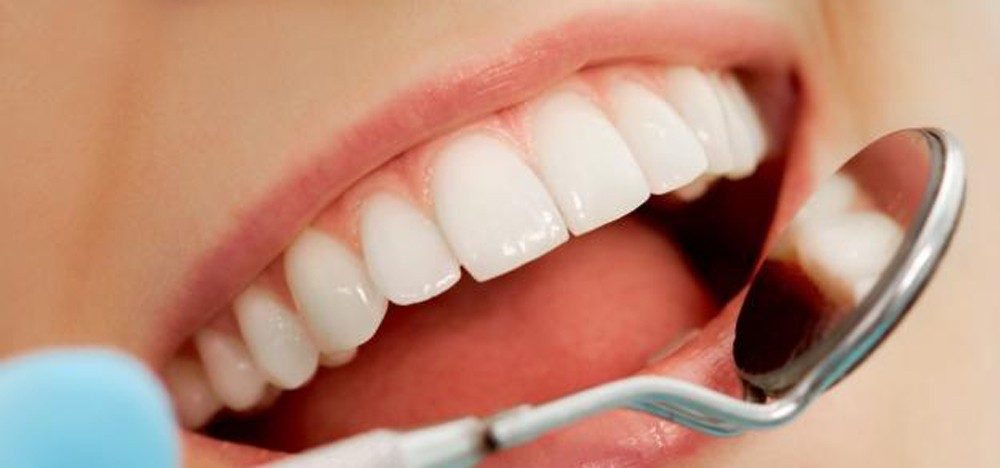 مکمل های طبیعی برای سلامت دندان و دهان