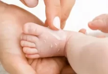 پوسته شدن بدن نوزاد؛ طبیعی یا نگران‌کننده؟