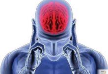 آلزایمر در کمین است؟ این نشانه‌ها را نادیده نگیرید
