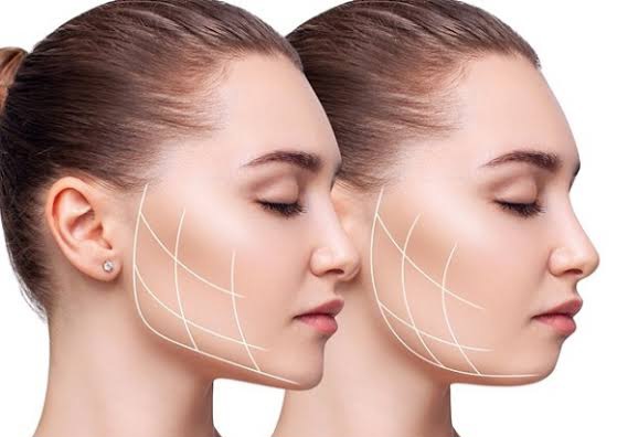 با این روش بدون جراحی زاویه فک تو قشنگ کن