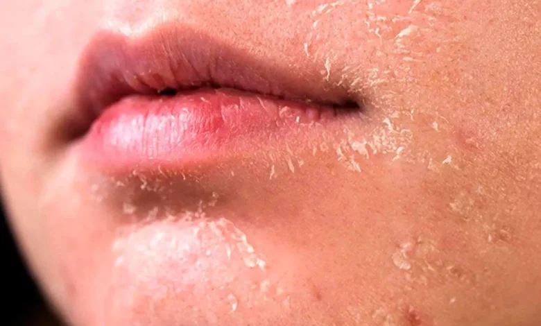 ۵ روش برای مراقبت از پوست در زمستان