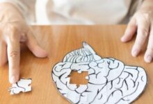 علائم اولیه آلزایمر